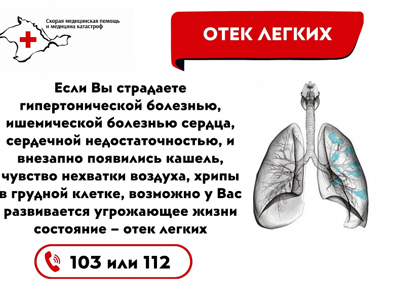 Оказание первой помощи